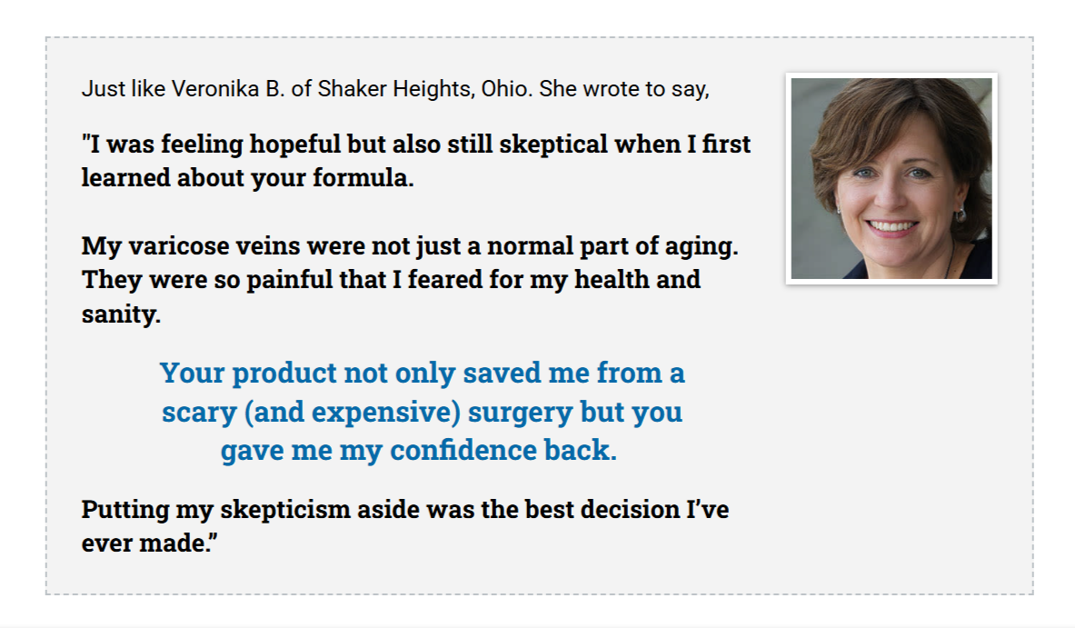 VariCose 911 Customer Reviews